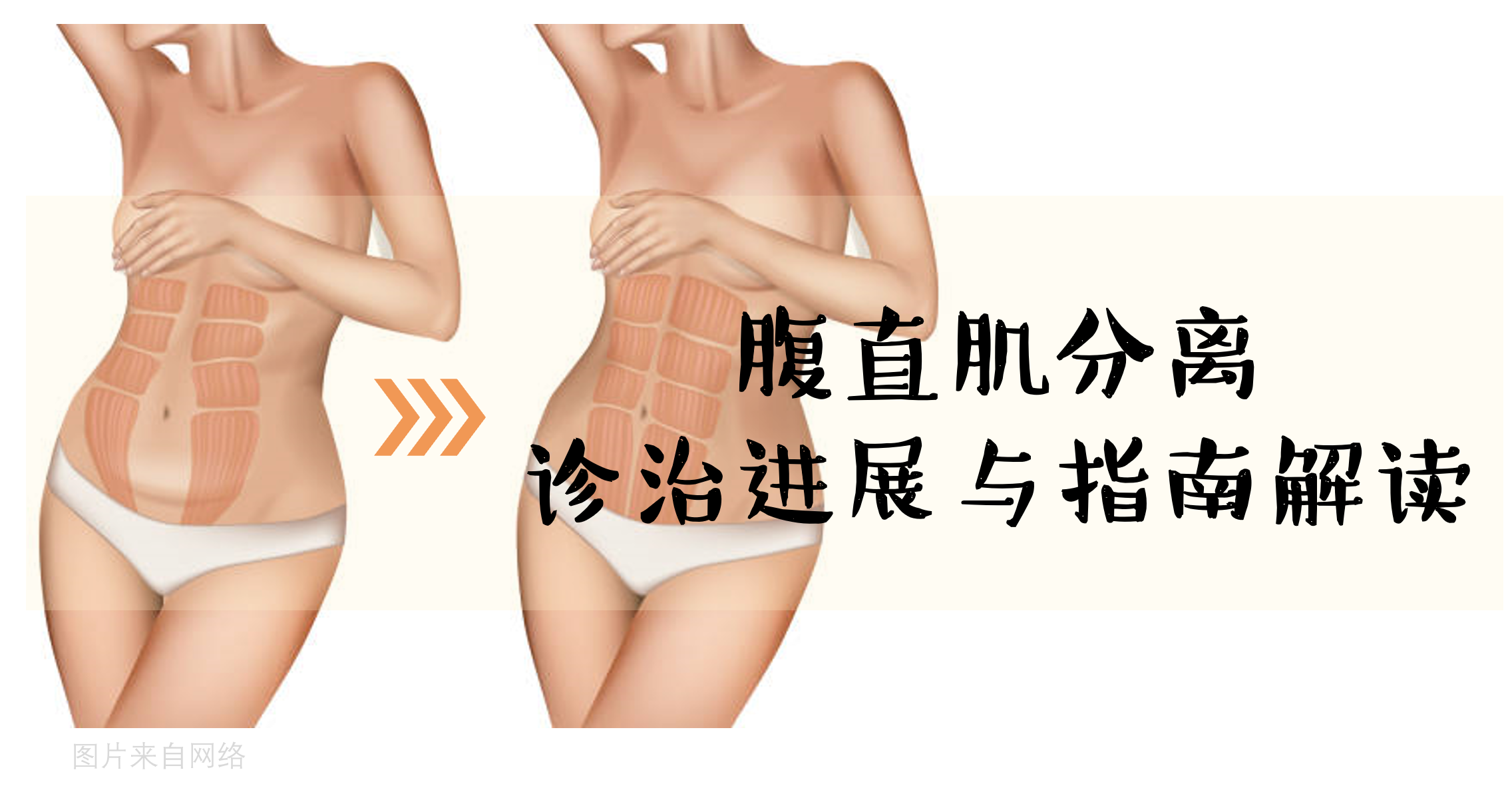 圖文圖片