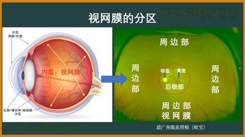 2 视网膜分区.png