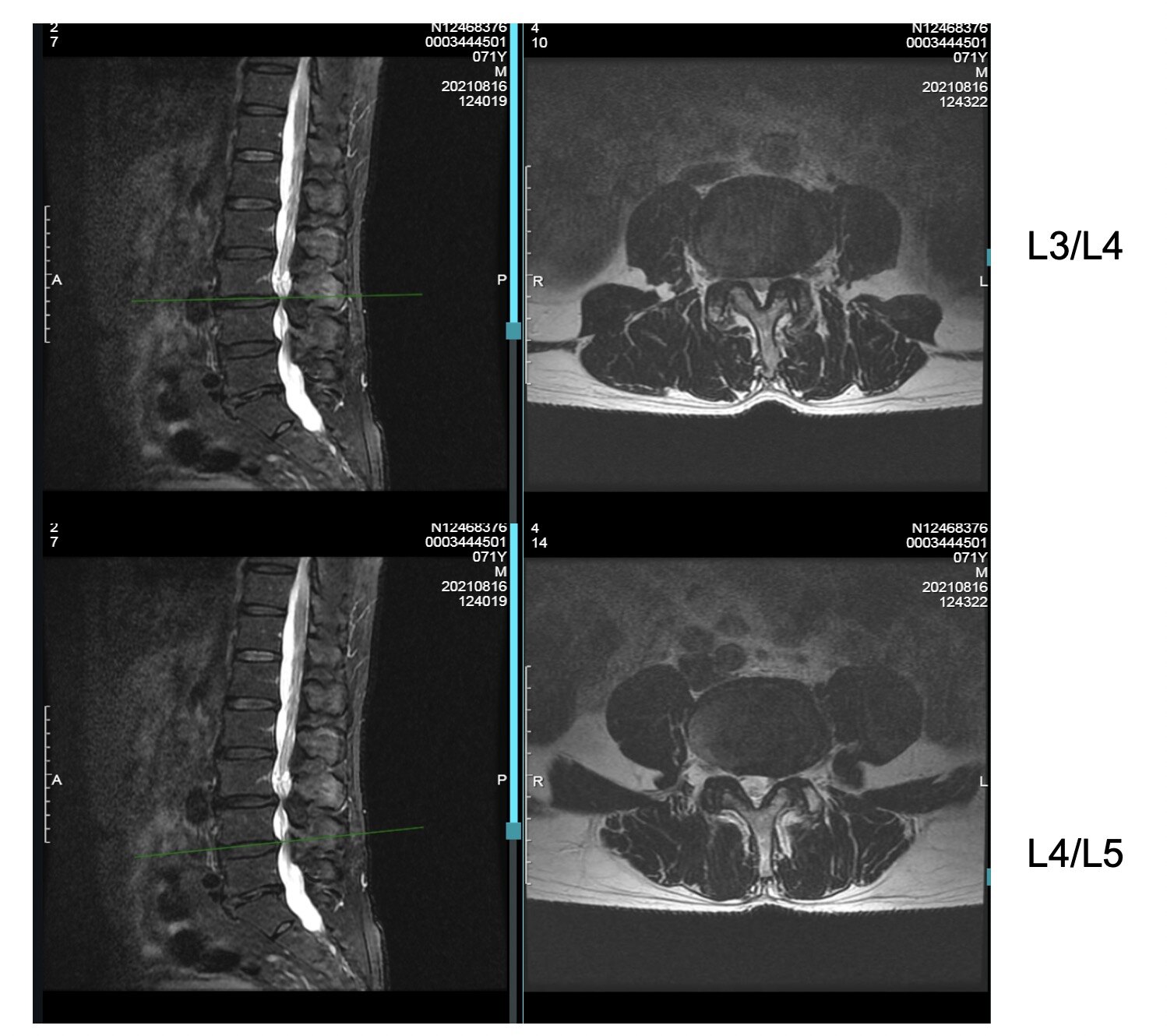 MRI.jpg