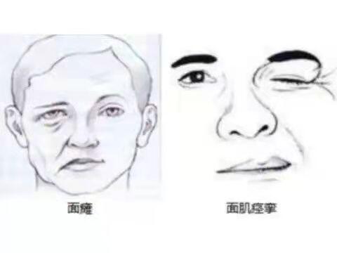 圖文圖片