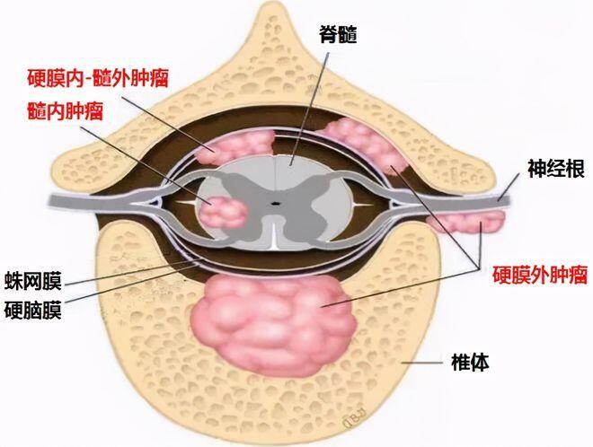 图文图片