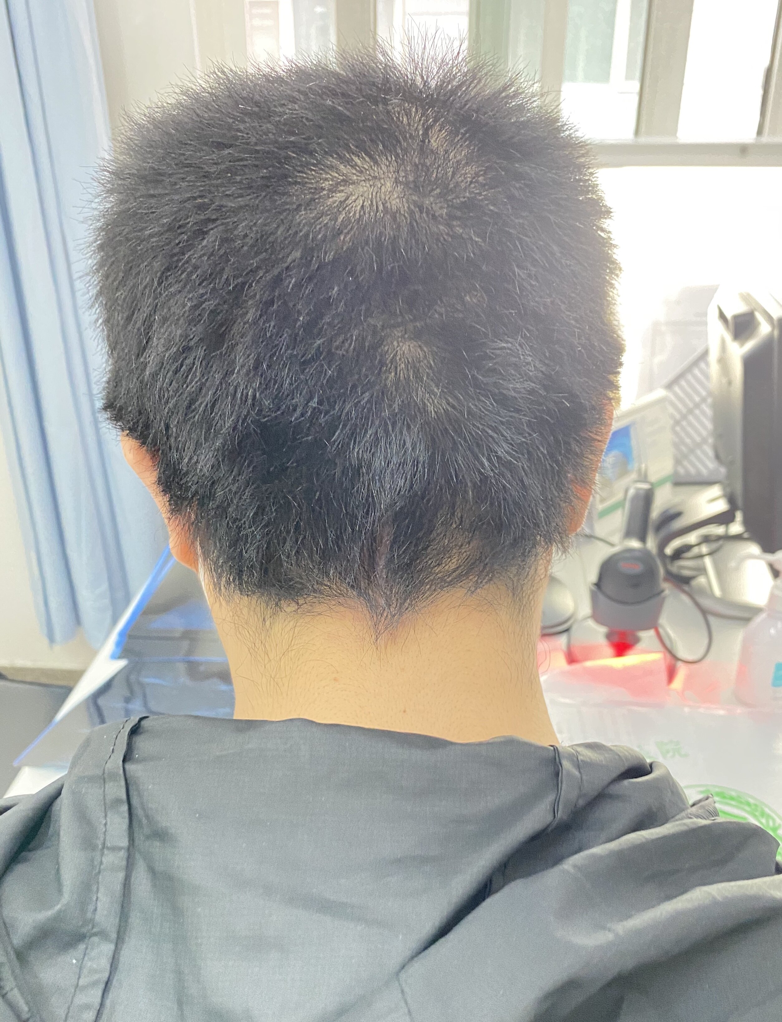 宣武医院核磁加急找黄牛 宣武医院核磁加急找黄牛