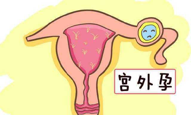 什么叫做特殊情况 2IYBAGK68gCAWX2kAABLzTlB7Kc641.jpg?_ms_=74ee