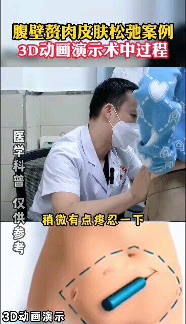 視頻封面