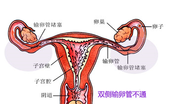 子宫卵巢输卵管示意图图片
