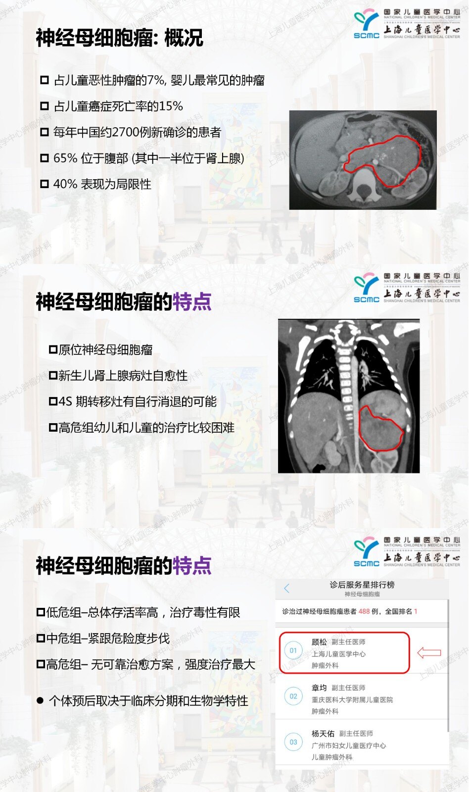 神經母細胞瘤的概況及特點