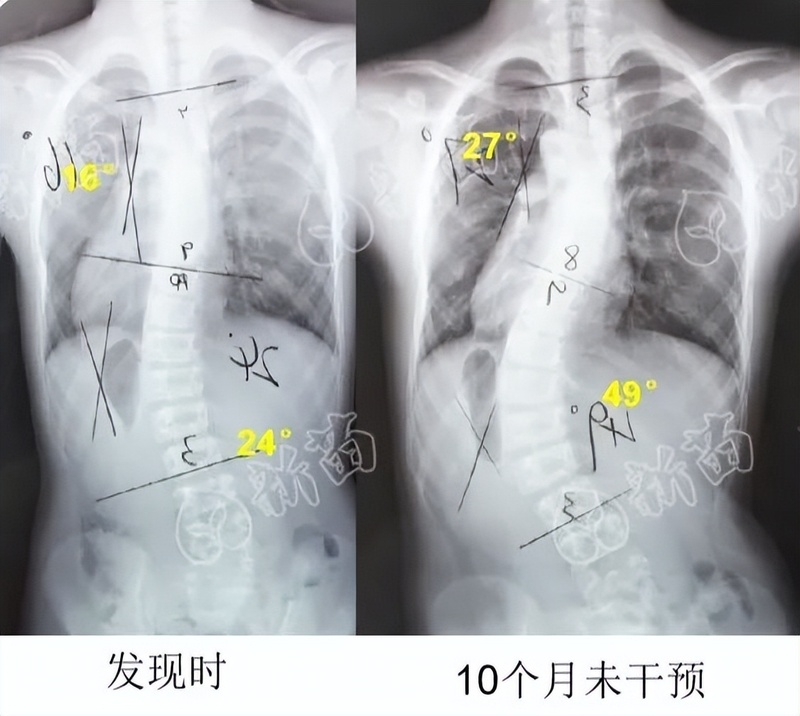 圖文圖片
