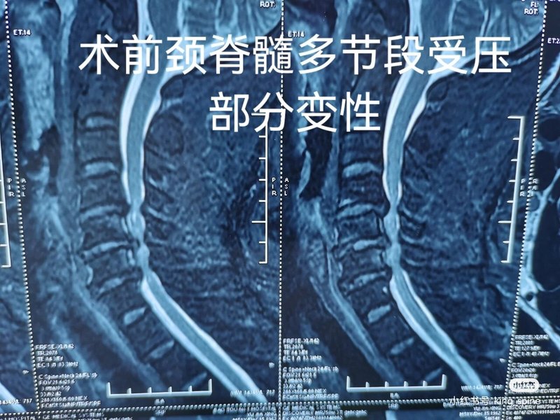 圖文圖片