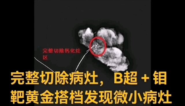 視頻封面