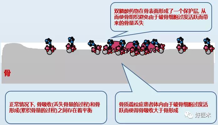 还是钙剂/维生素d联合补充均不能降低50岁以上中老年人骨折的发生率!