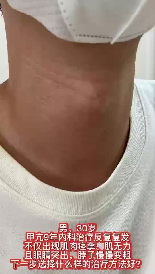 視頻封面
