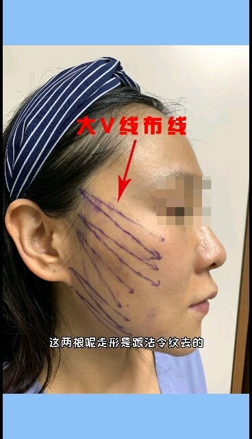 視頻封面