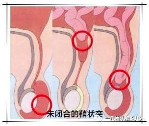 圖文圖片