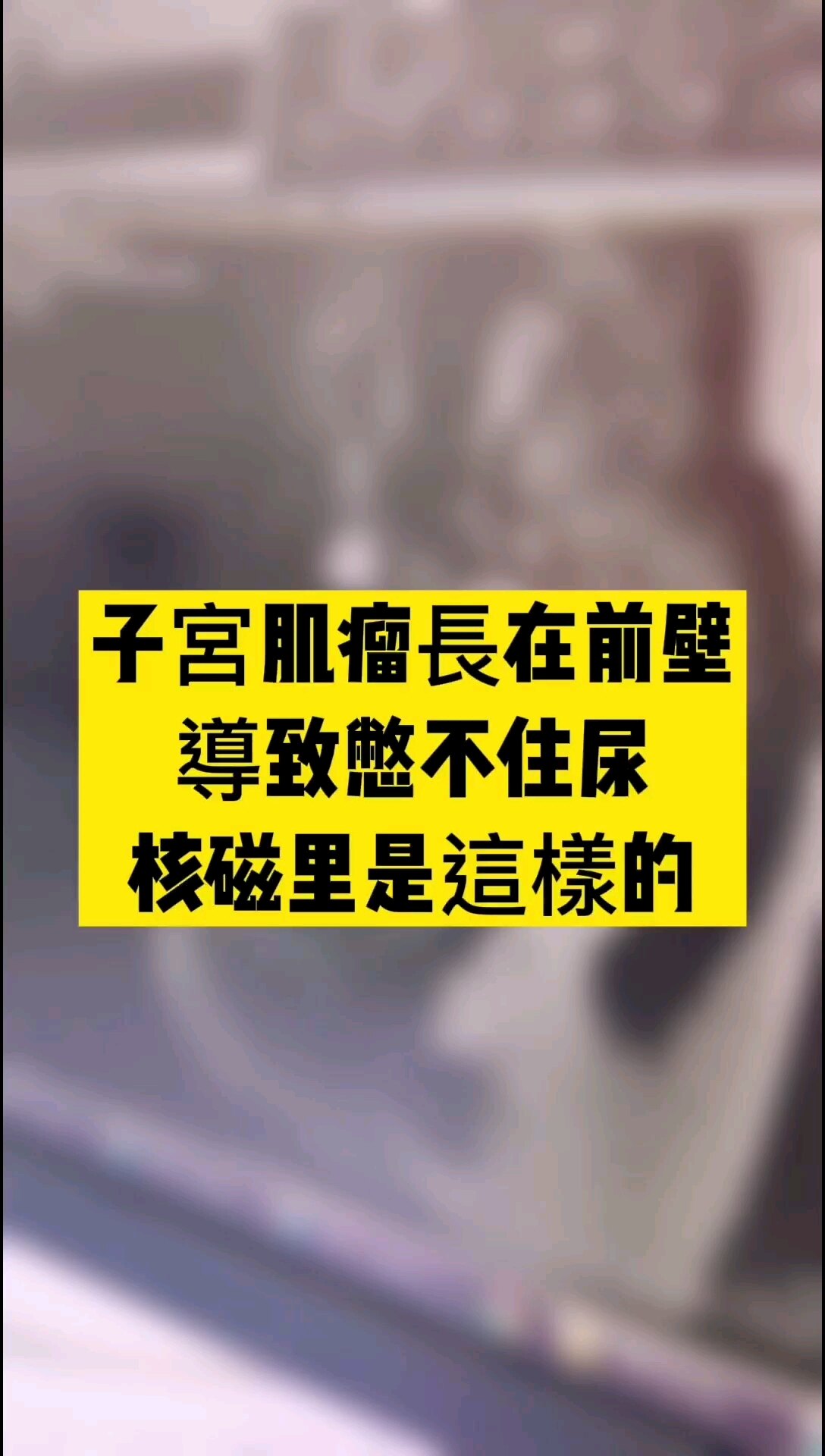 默认图片