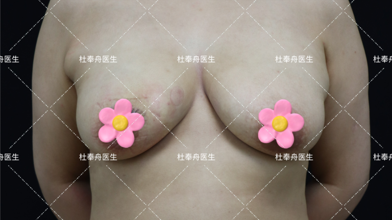 圖文圖片