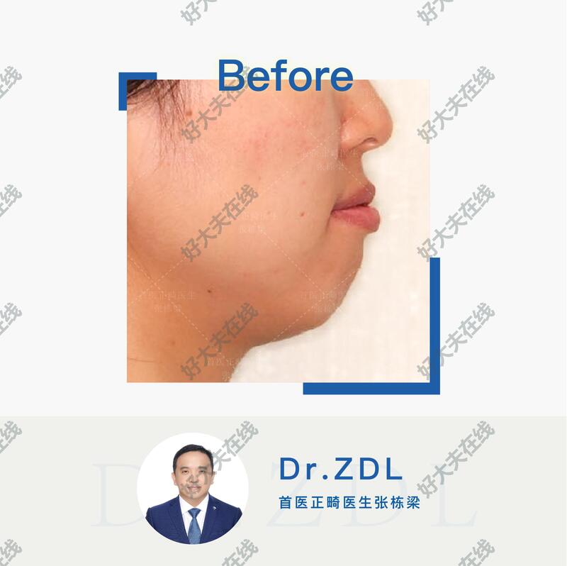 圖文圖片