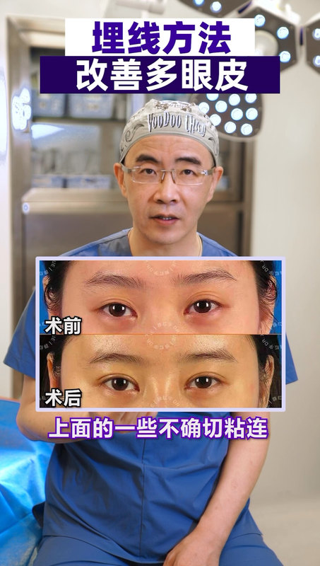 視頻封面