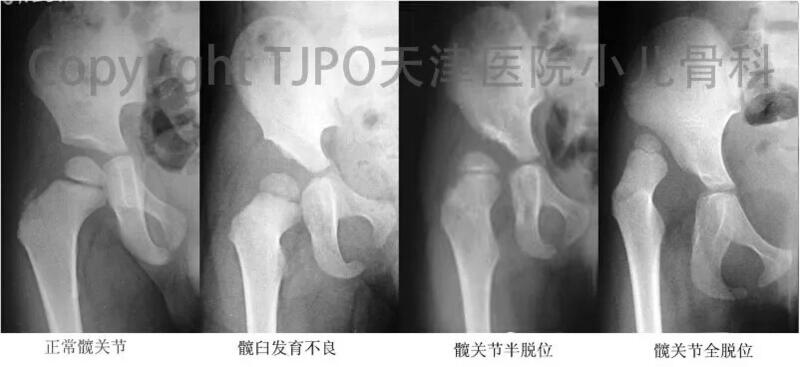 圖文圖片