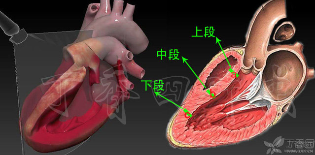 心脏解剖笔记:右房右室篇 
