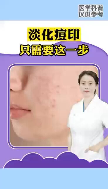 視頻封面