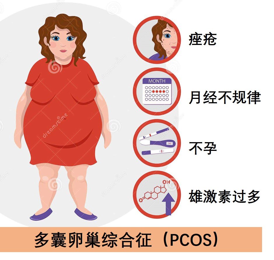 多囊样改变图片