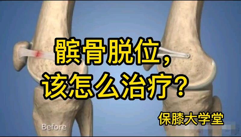 視頻封面