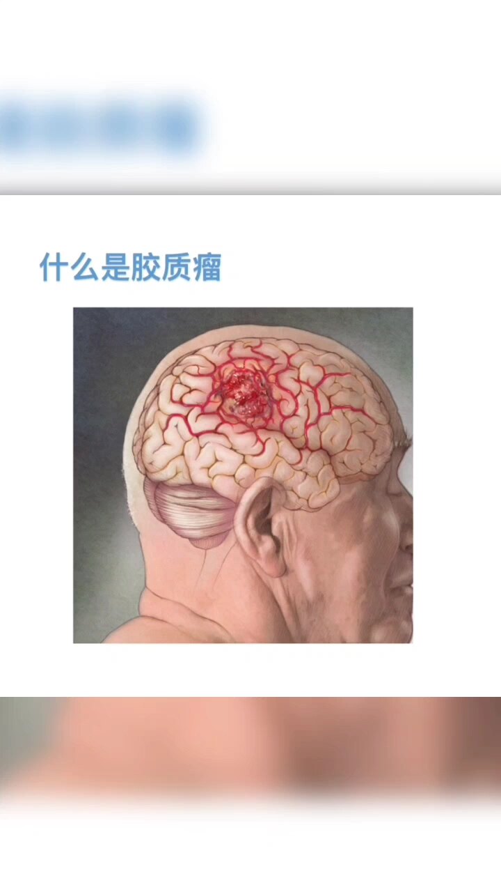 默认图片