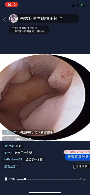視頻封面