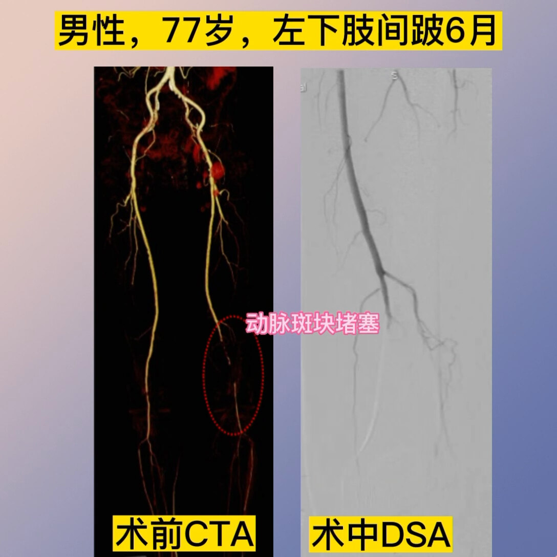 默认图片