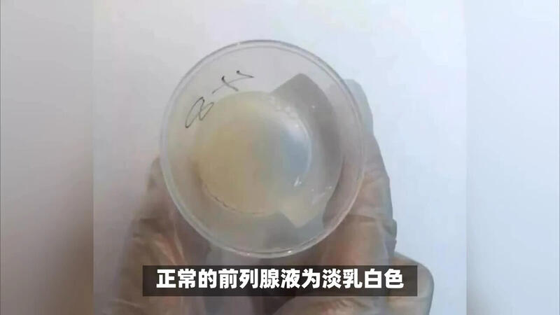 視頻封面