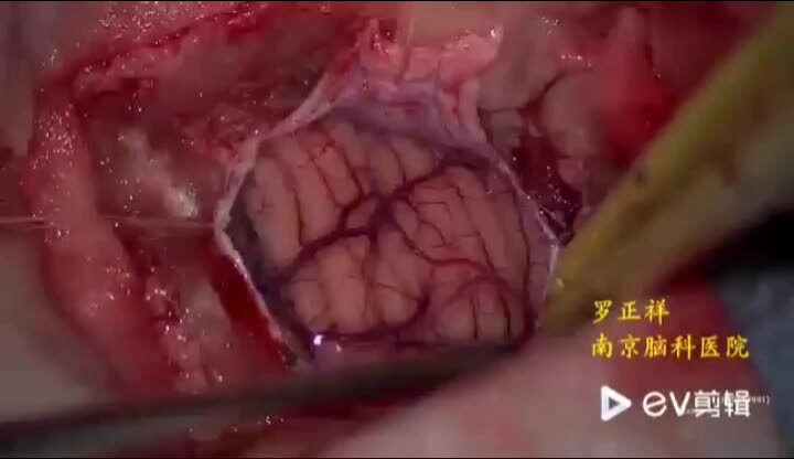 視頻封面