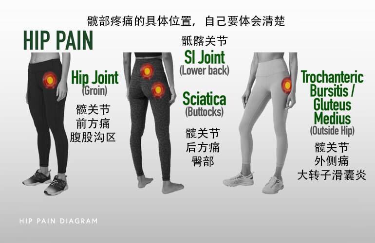 髖關節前方疼痛(大腿根部腹股溝中點區域)通常是髖關節本身的問題所致