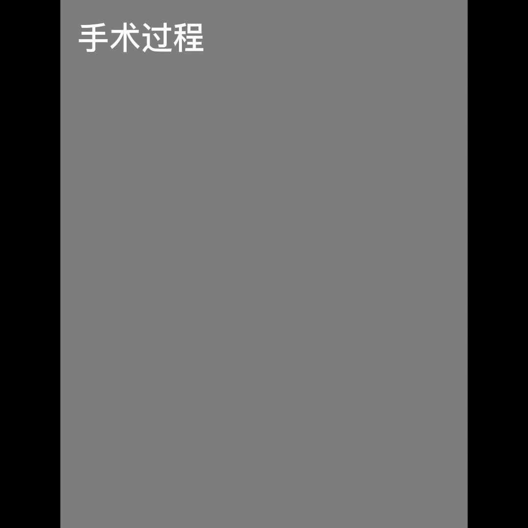 視頻封面
