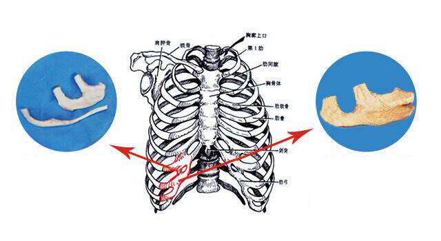 肋骨1.jpg