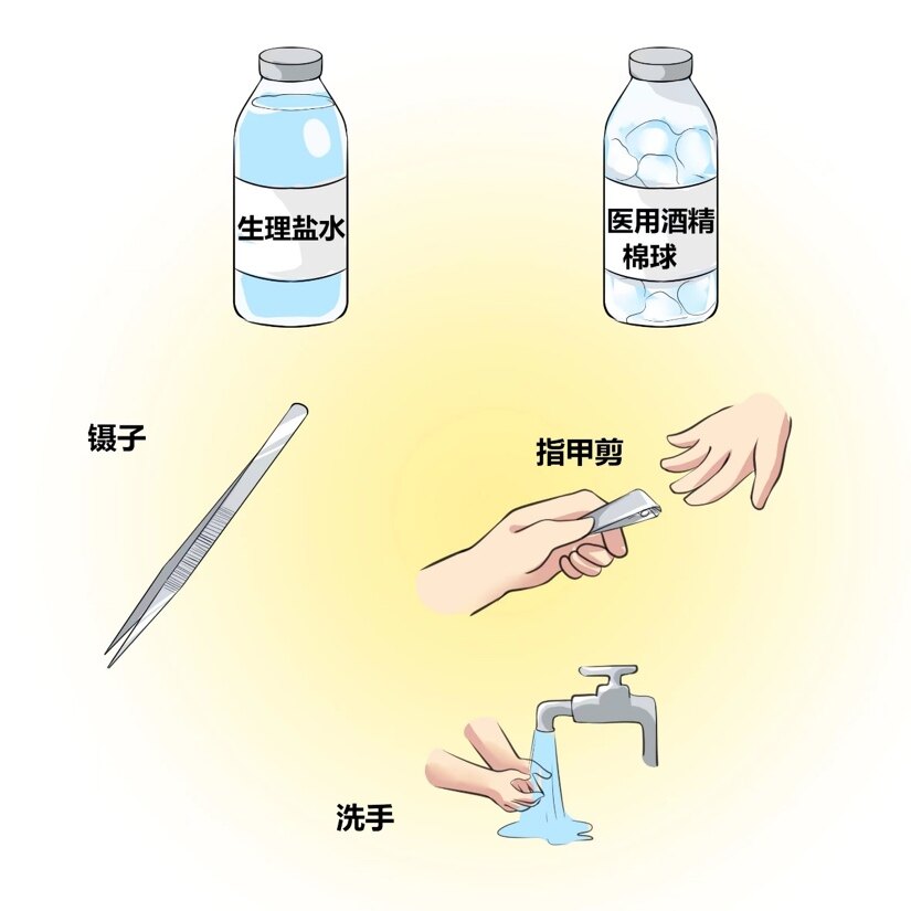 切口护理的物品准备:①医用酒精棉球或者生理盐水棉球(可以在正规药店