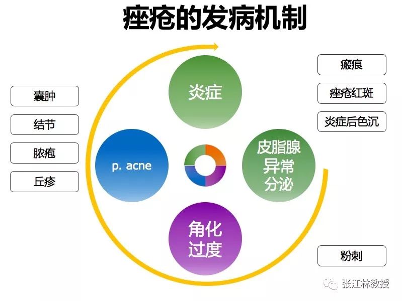 虽然异维a酸软胶囊作用机制尚未完全清楚,但研究证明它用于治疗痤疮时