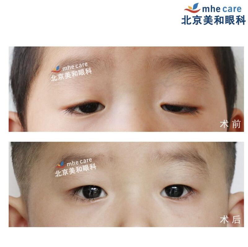 圖文圖片