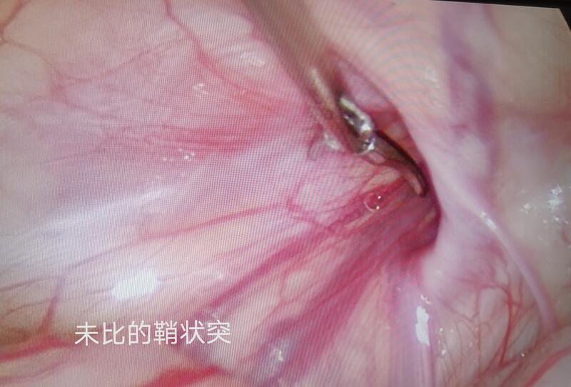圖文圖片