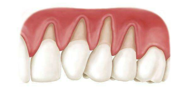 正畸 - 好大夫在线