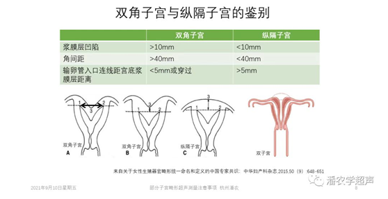 Alipay