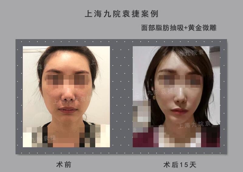 圖文圖片