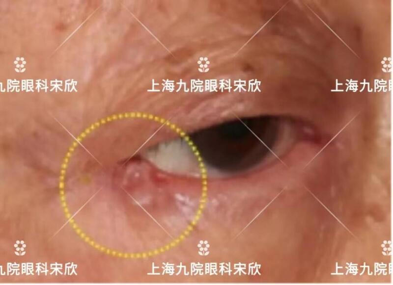 圖文圖片