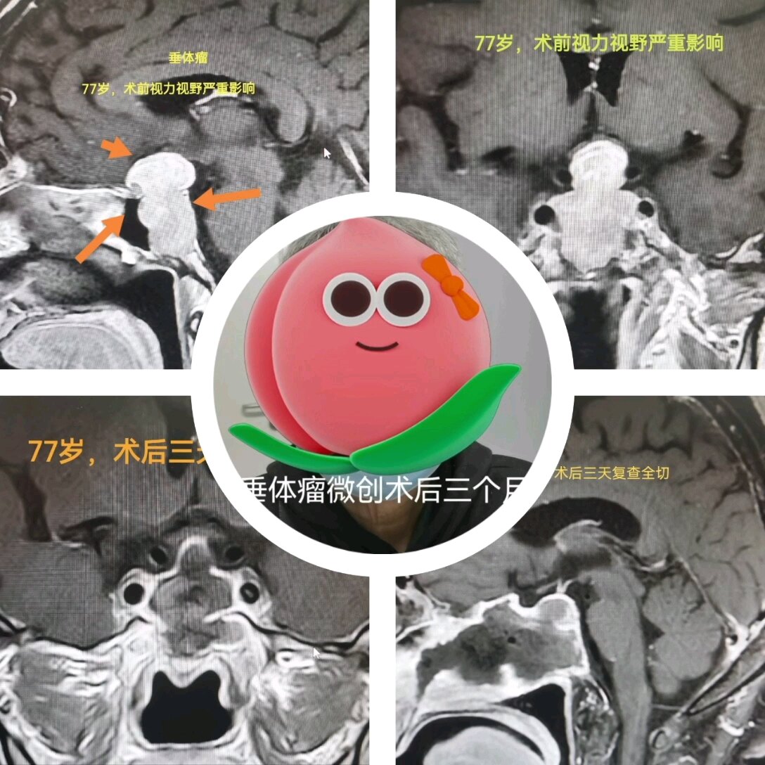 默认图片