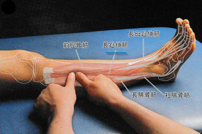趾长伸肌的解剖与激痛点