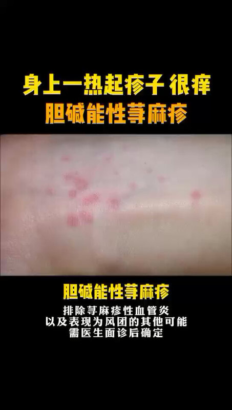 視頻封面