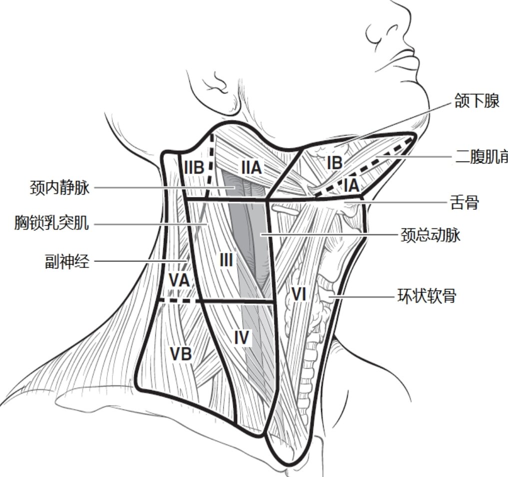 颈部淋巴结分区图解图片