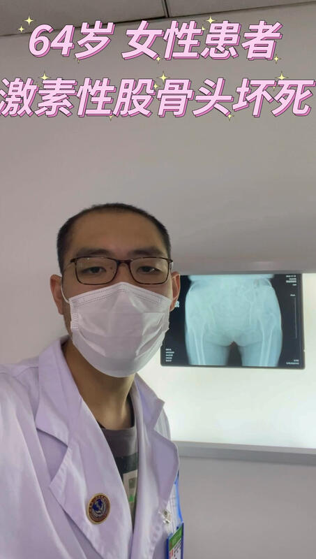 激素性股骨头坏死