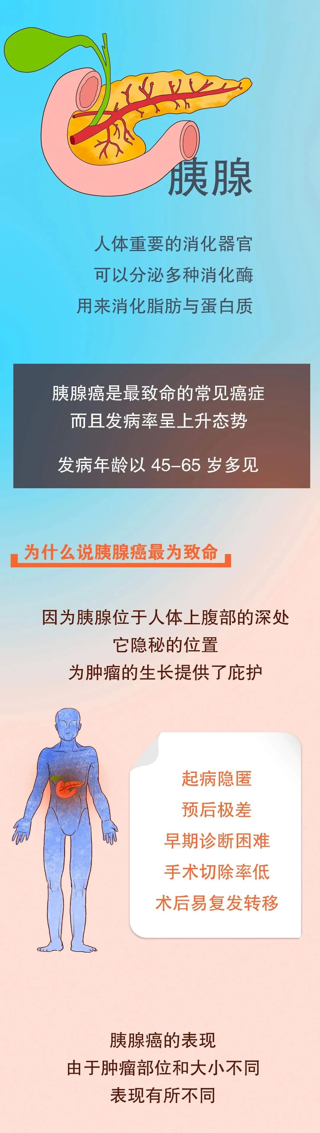 惹不起的癌症之王胰腺癌做到4點有效預防