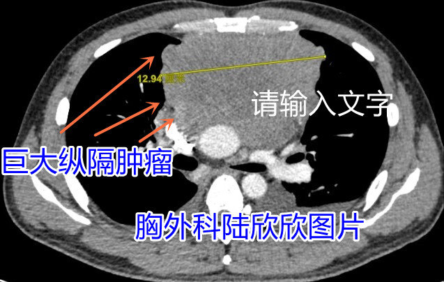 发病时肿瘤水印.jpg