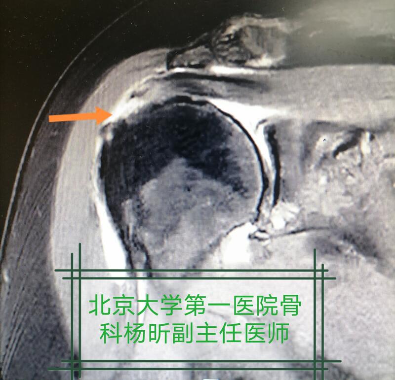 圖文圖片